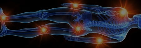 関節リウマチ製品バナー