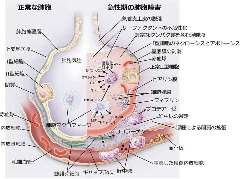 COVID-19
                    
                疾病の経過
            医療関係者の皆さまへ