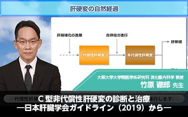 C型非代償性肝硬変の診断と治療―日本肝臓学会ガイドライン（2019）から―