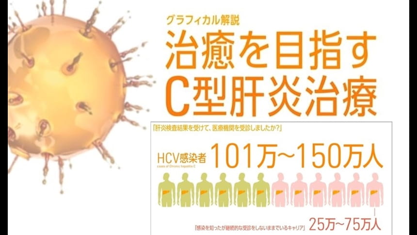 グラフィカル解説『治癒を目指すC型肝炎治療』第1回：C型肝炎の概要と抗ウイルス療法