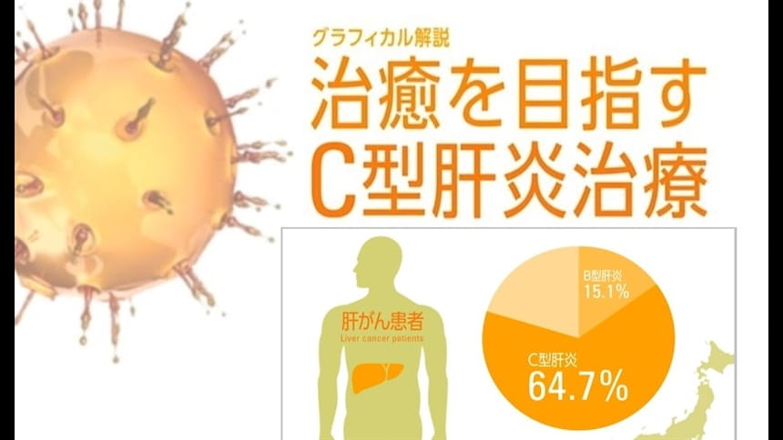 グラフィカル解説『治癒を目指すC型肝炎治療』第2回：C型肝炎治療の重要性～肝がんリスク～