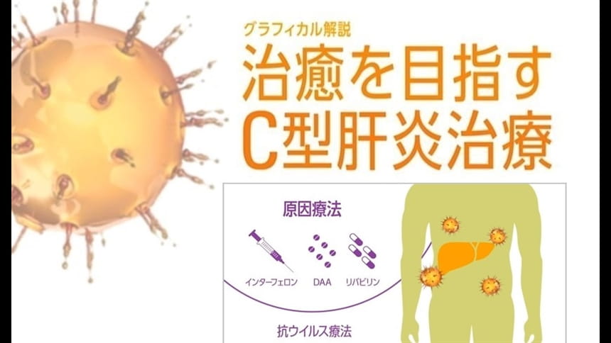 グラフィカル解説『治癒を目指すC型肝炎治療』第5回：C型肝炎の抗ウイルス療法