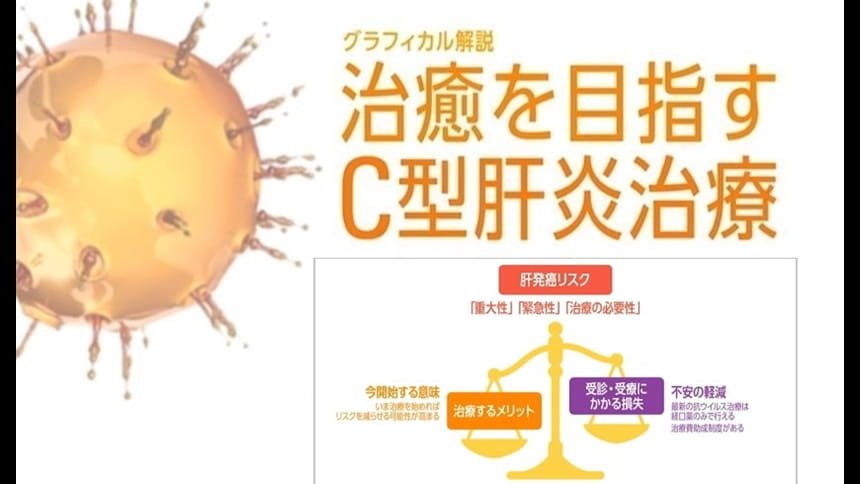 グラフィカル解説『治癒を目指すC型肝炎治療』第6回：肝臓専門医の受診を勧める際のポイント