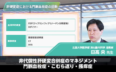 非代償性肝硬変合併症のマネジメント 門脈血栓症・こむら返り・掻痒症