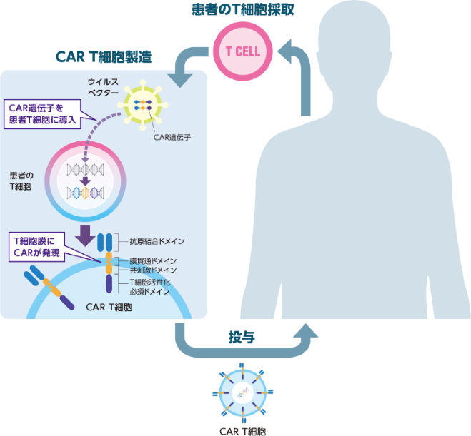 CAR T細胞療法のイメージ図